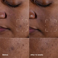 Sérum Anti-Taches Even Better Clinical™