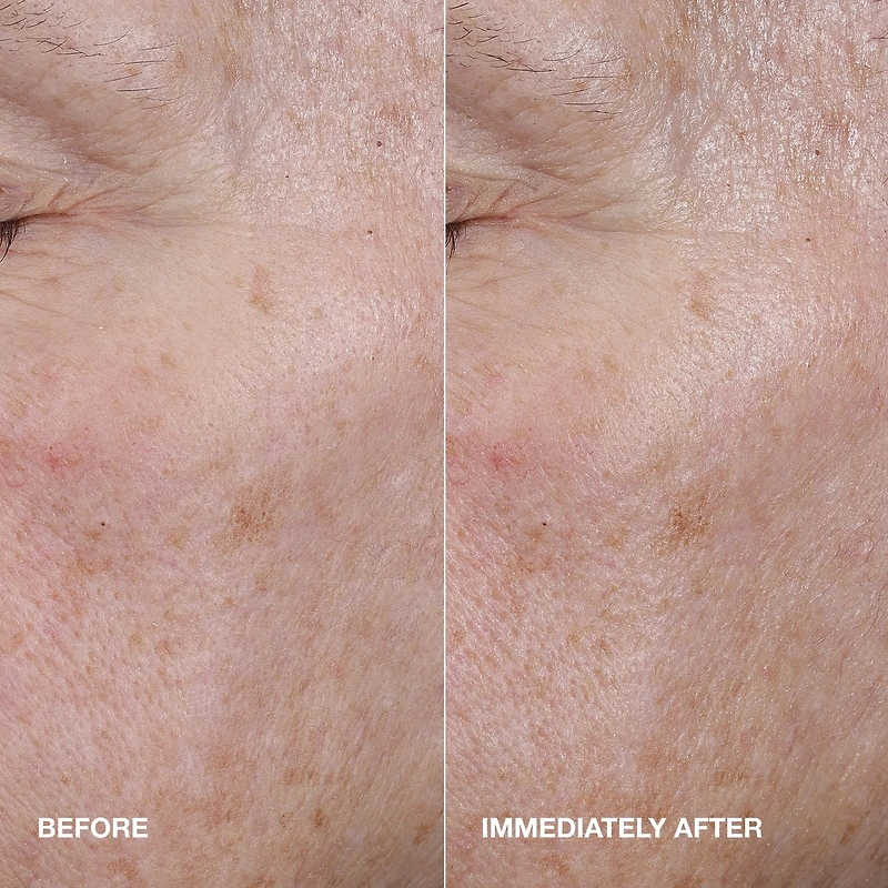 Sérum éclat actif Moisture Surge™