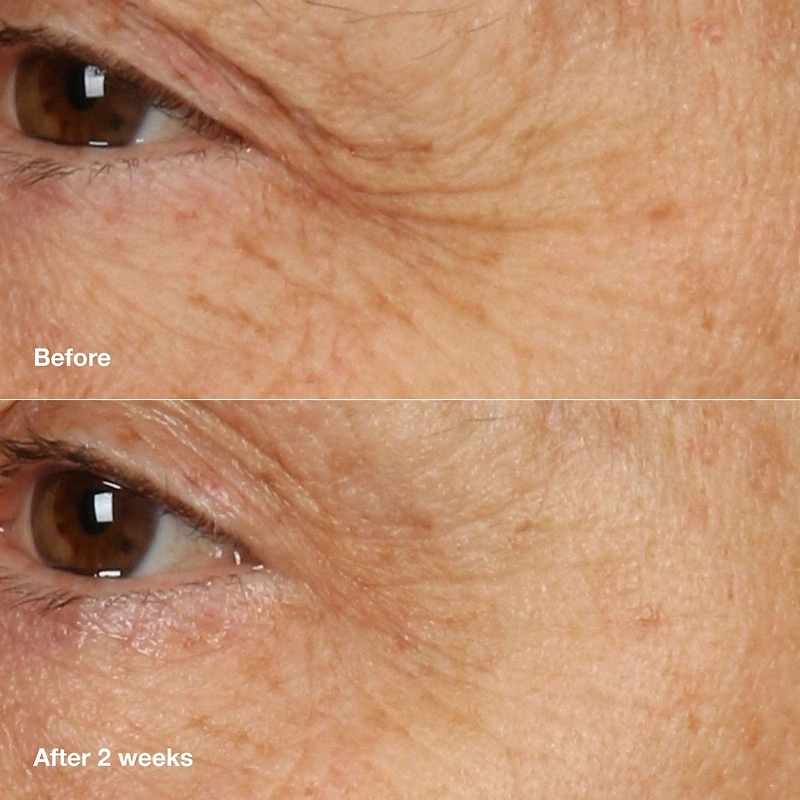 Clinique Smart Clinical Repair™ Overnight Recovery Cream + Mask