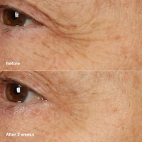 Clinique Smart Clinical Repair™ Overnight Recovery Cream + Mask