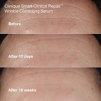 Wrinkle Fighting Routine Anti-Aging Skincare Gift Set