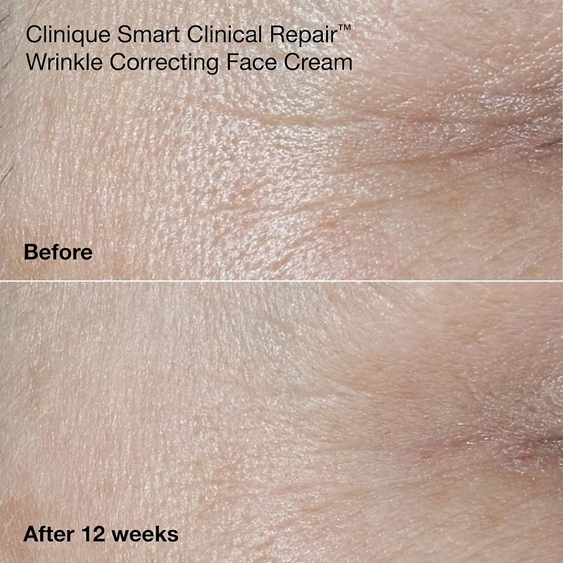 Wrinkle Fighting Routine Anti-Aging Skincare Gift Set