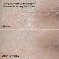 Wrinkle Fighting Routine Anti-Aging Skincare Gift Set