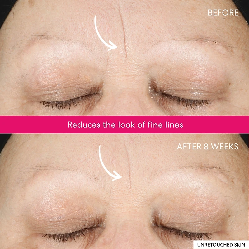 Gommage Éclat Phyto-lactique 10 % Ageless