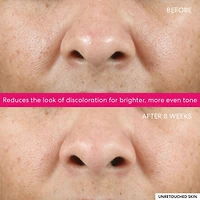Gommage Éclat Phyto-lactique 10 % Ageless