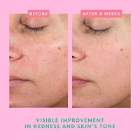 Bora Barrier™ Crème réparatrice
