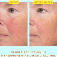 C-Luma™ Hydrabright Serum