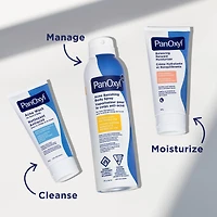 Acne Banishing Body Spray