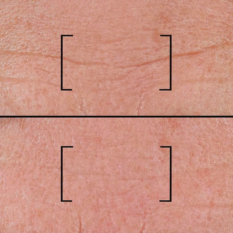 Time-filler Intensive 5xp