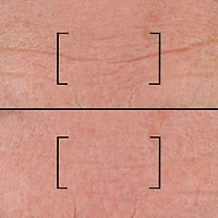 Time-filler Intensive 5xp