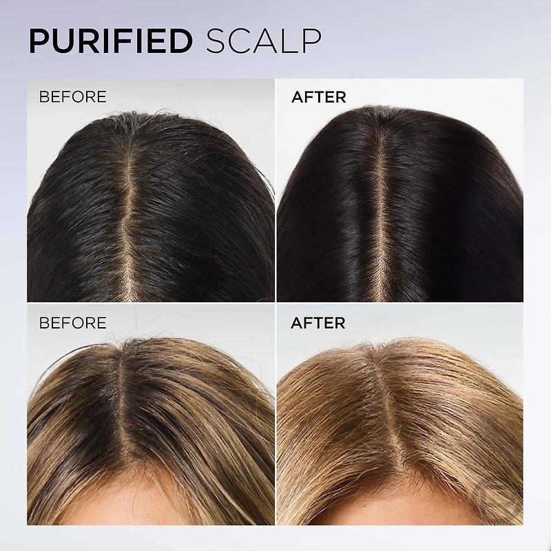 Hyaluron Pure Oil Erasing Scalp Serum, 102ml