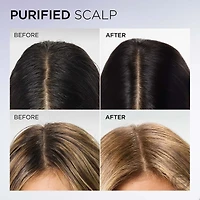 Hyaluron Pure Oil Erasing Scalp Serum, 102ml