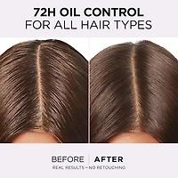 Hyaluron Pure Oil Erasing Scalp Serum, 102ml