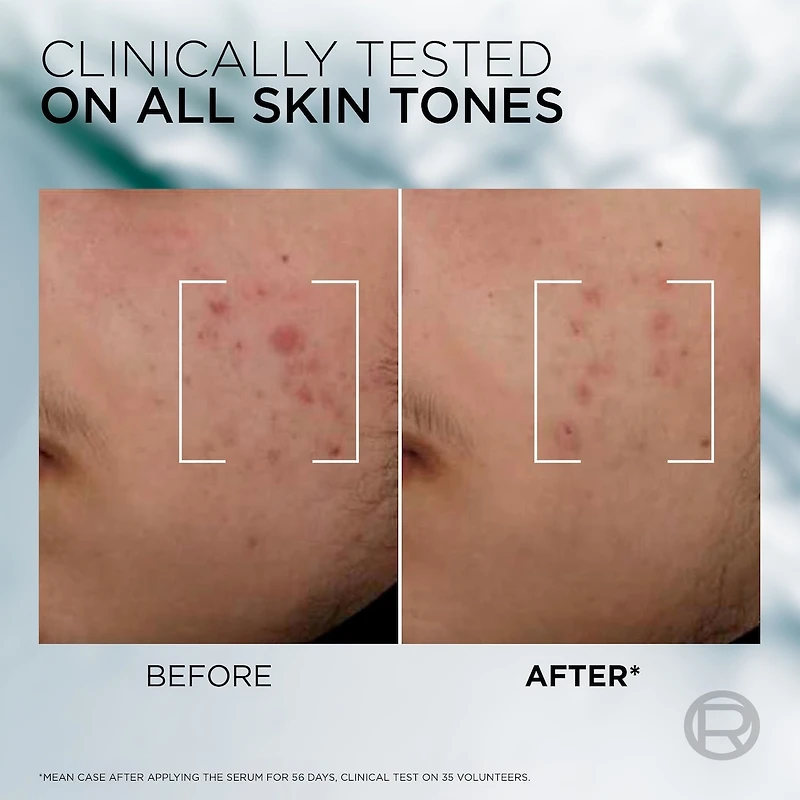 Men Expert Derma Power Correcting Serum