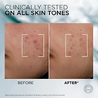 Men Expert Derma Power Correcting Serum