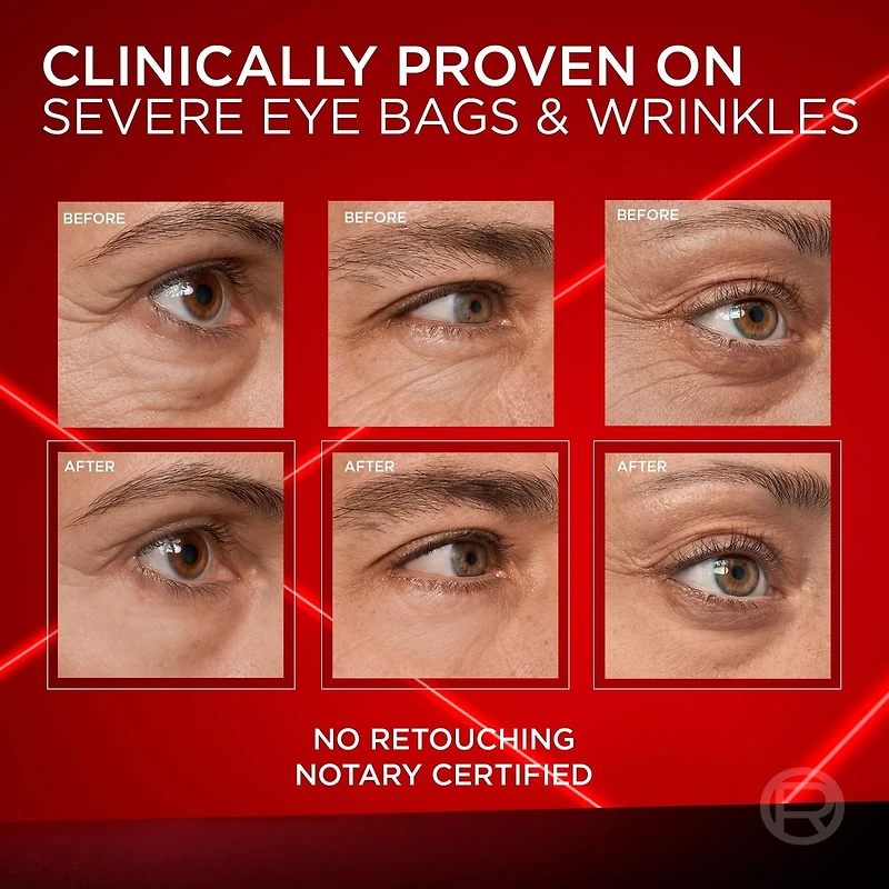 Revitalift Triple Power LZR Eye Cream Instant Eraser 15 mL