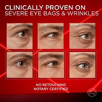 Revitalift Triple Power LZR Eye Cream Instant Eraser 15 mL