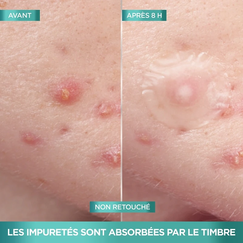 Timbres Imperfection Invisibles, 22 Unités