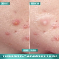 Timbres Imperfection Invisibles, 22 Unités