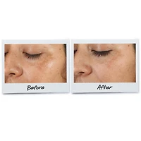 Clearly Corrective™ Dark Spot Solution