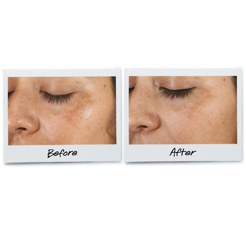 Clearly Corrective™ Dark Spot Solution