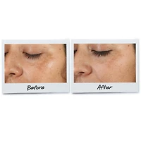 Clearly Corrective™ Dark Spot Solution