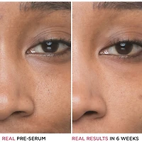 10% D'acide Glycolique, Acide Hyaluronique Sérum Concentré Bye Bye Pores