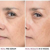1,5% Acide Hyaluronique, Peptide Bye Bye Lines Sérum Concentré