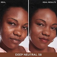 Bye Dark Spots Concealer + Serum with 2% Niacinamide

INSTANT NATURAL COVERAGE CLINICALLY FADES DRAK SPOTS*