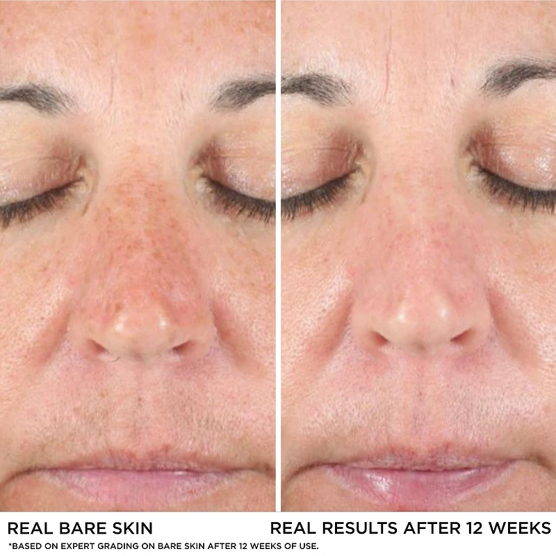 Bye Dark Spots Concealer + Serum with 2% Niacinamide

INSTANT NATURAL COVERAGE CLINICALLY FADES DRAK SPOTS*