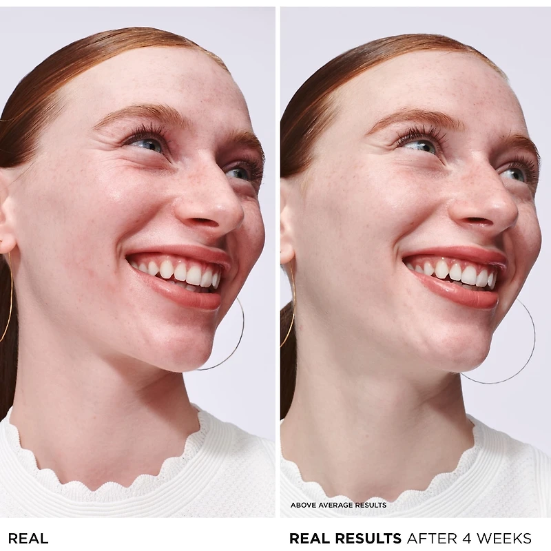 Sérum Bye Bye Redness - Soulagement instantané de la peau sensible avec niacinamide