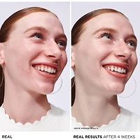 Sérum Bye Bye Redness - Soulagement instantané de la peau sensible avec niacinamide