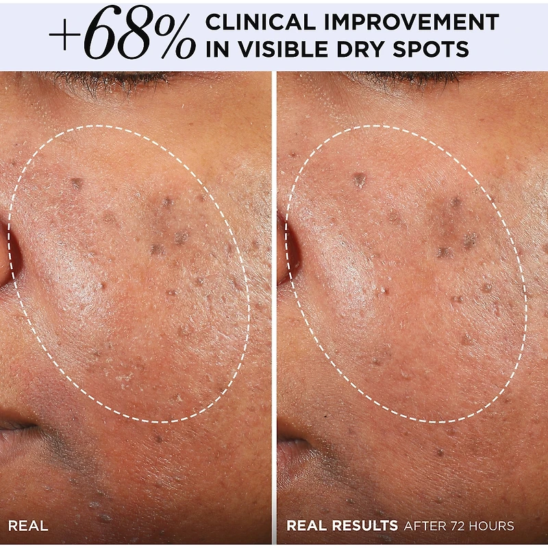 Confidence in a Cream Barrier Boost Moisturizer