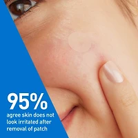 Anti-Spot Barrier Patches