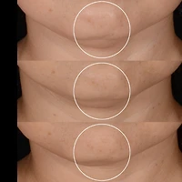 Rénergie H.P.N. 300-Peptide Refill