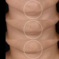 Coffret cadeau Rénergie C.R.X. Triple Sérum Rétinol