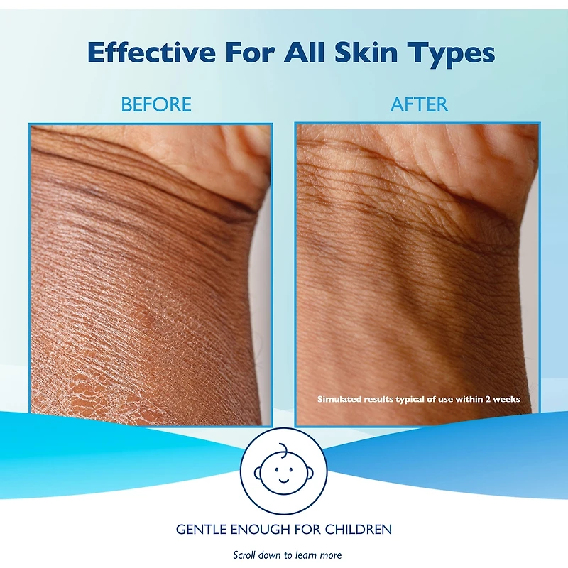 Glaxal Base Moisturizing Cream