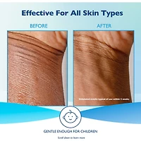 Glaxal Base Moisturizing Cream