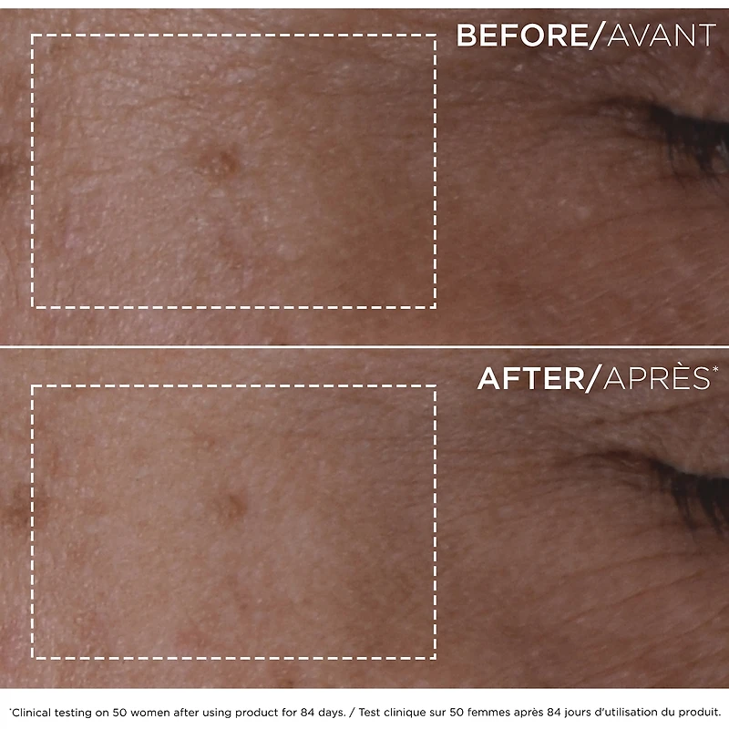 Double Serum
