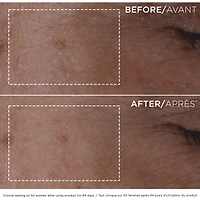 Double Serum