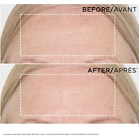 Double Serum