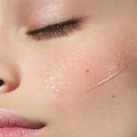 Lotion Tonique Purifiante