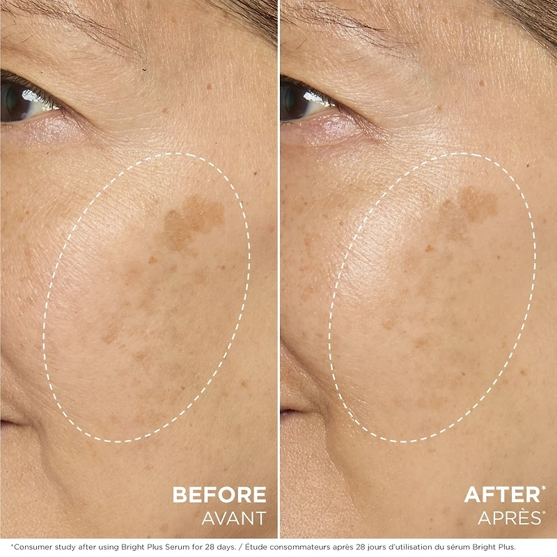 Bright Plus [Advanced] Serum