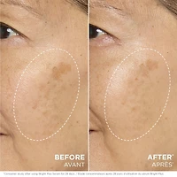 Bright Plus [Advanced] Serum