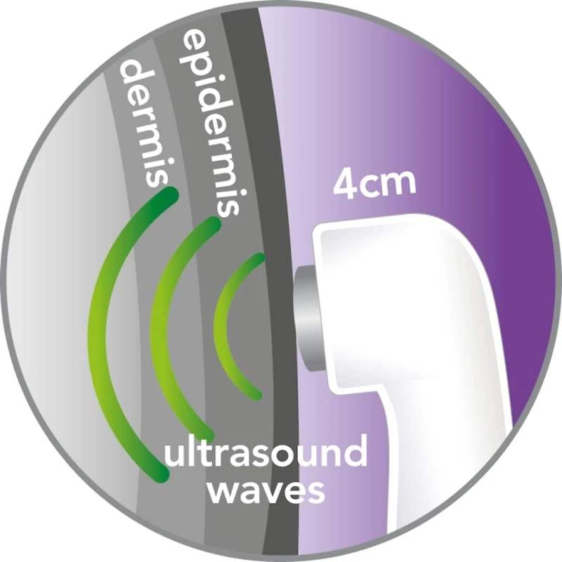 Revitive Ultrasound Device