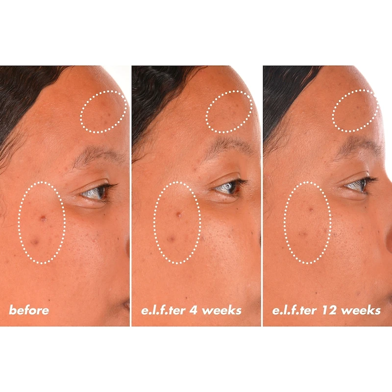 Sérum férulique avec vitamine C et E Bright Icon