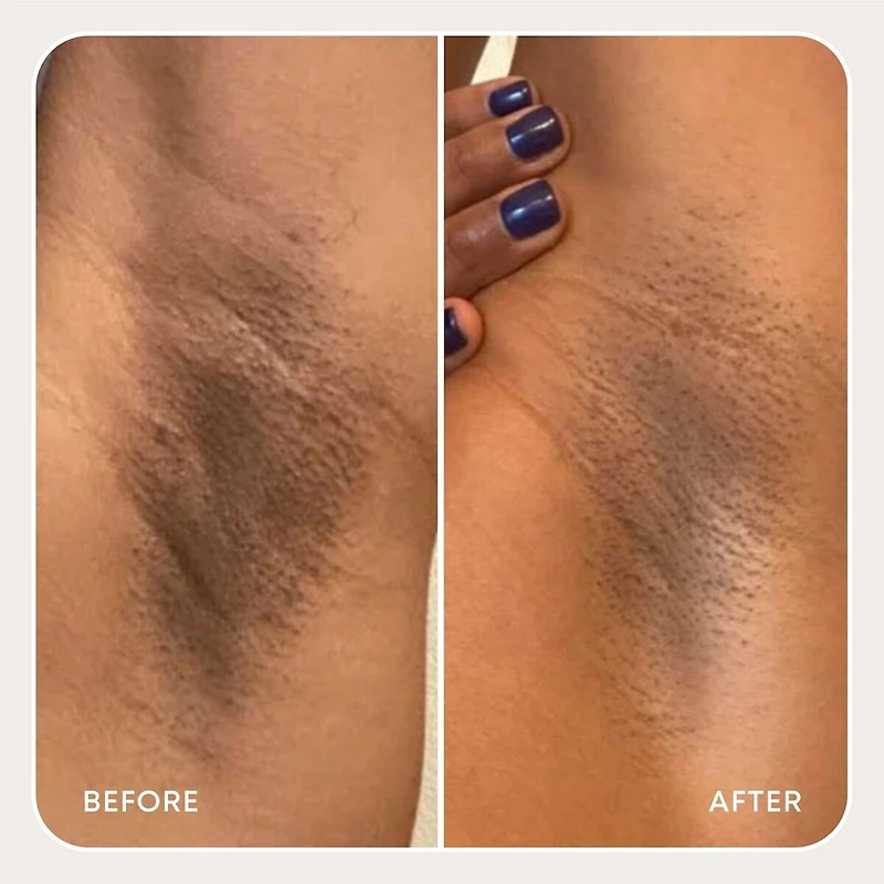 Bermuda Dark Spot Exfoliating Scrub