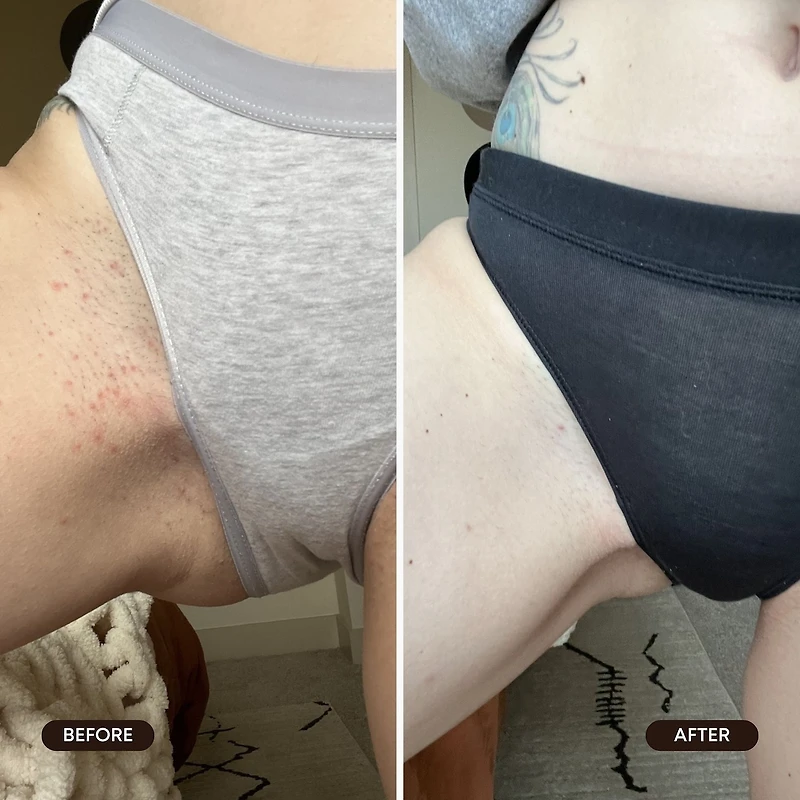 Poils Incarnés Gommage Exfoliante - Sucre de Melon D'Eau