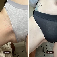 Poils Incarnés Gommage Exfoliante - Sucre de Melon D'Eau