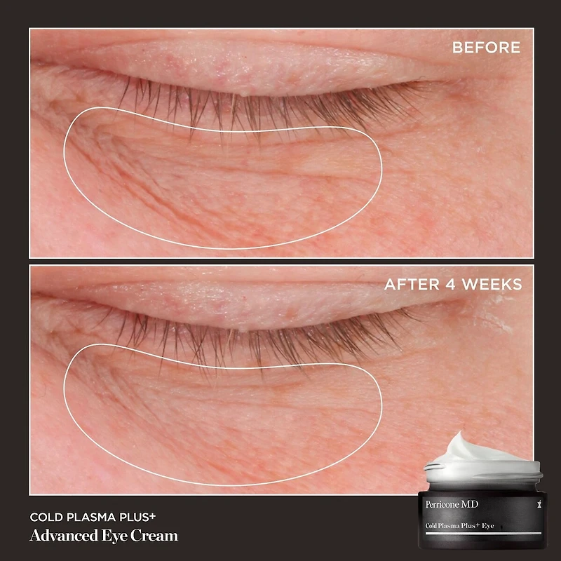 Cold Plasma Plus+ Advanced Eye Cream